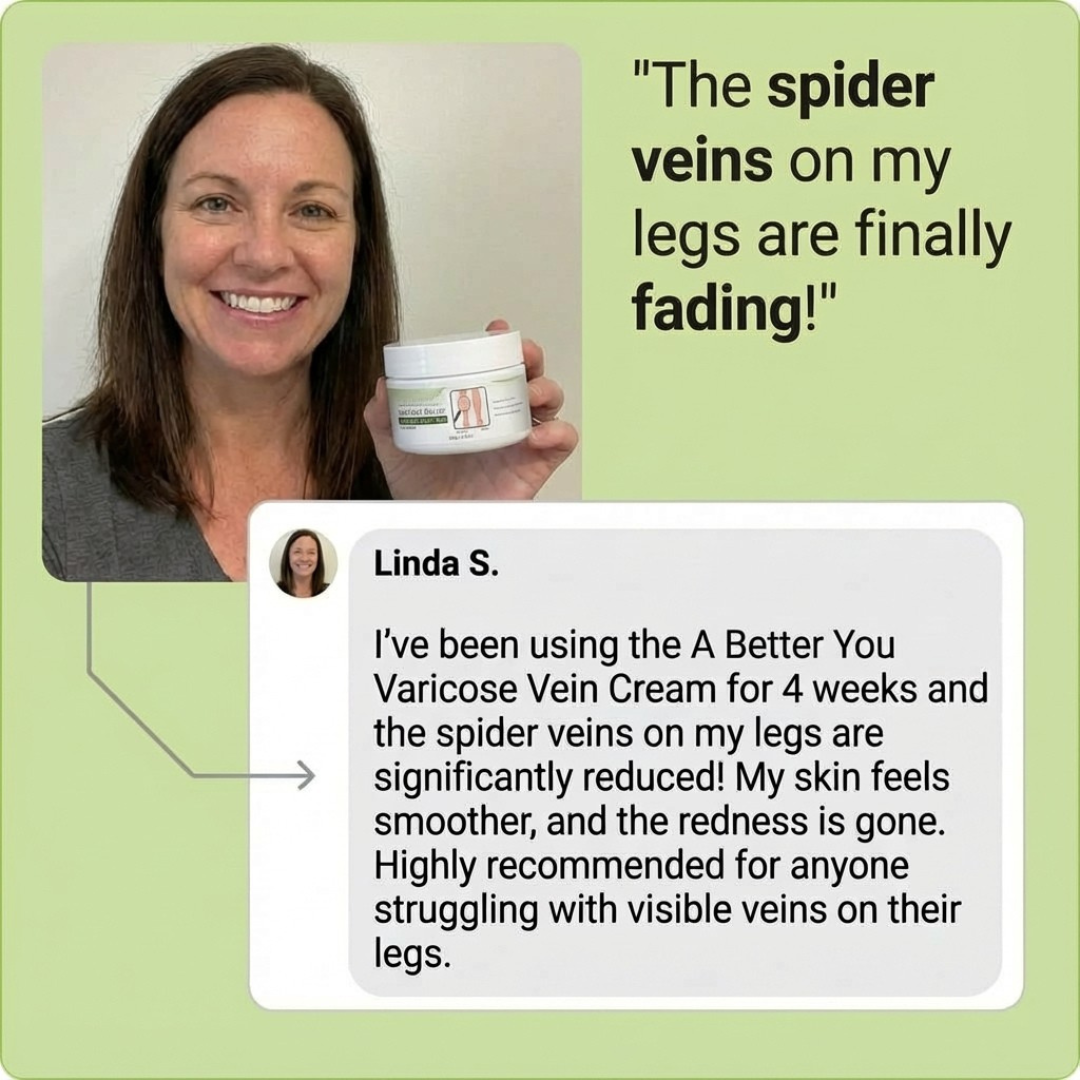 Varicose Vein Cream - 50g