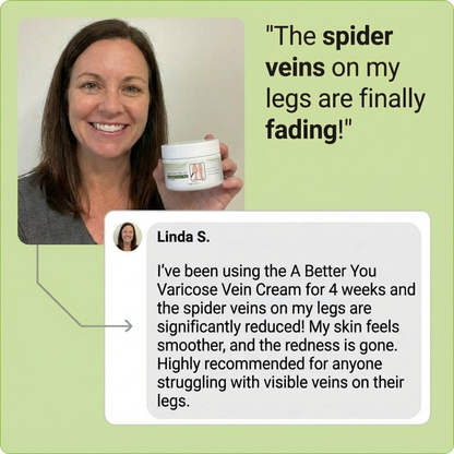 Varicose Vein Cream - 50g